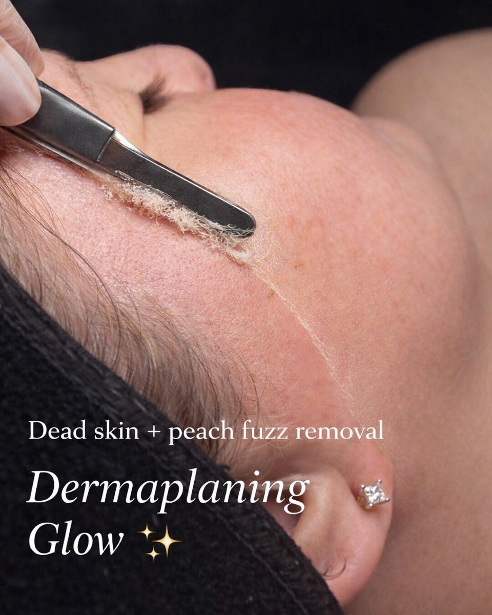 Dermaplaning Treatment